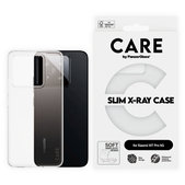 Θήκη X-Ray για Xiaomi 15T Pro 5G, Διαφανές, CARE